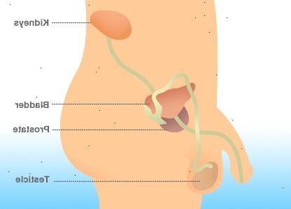 Hvordan krympe en forstørret prostata. Hvis du allerede har kjørt ut av alternativer.