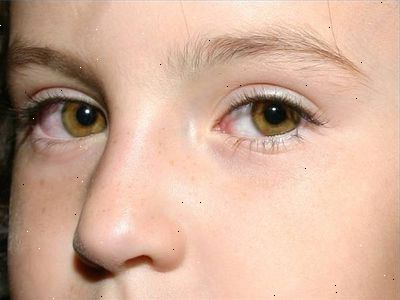 Hvordan å behandle post nasal drypp hos barn. Ta barnet vekk fra eksponering for allergener.