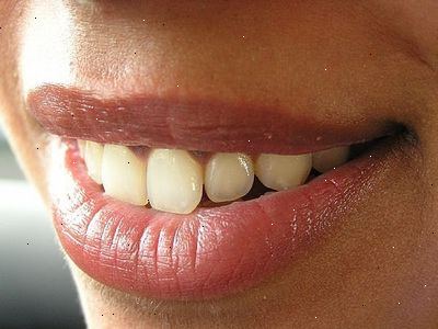 Hvordan å stoppe smerte fra sensitive tenner. Tannlege konsultasjoner.